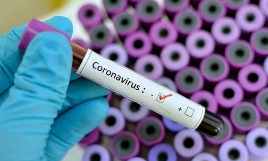U ŽZH registrirana samo tri nova slučaja koronavirusa