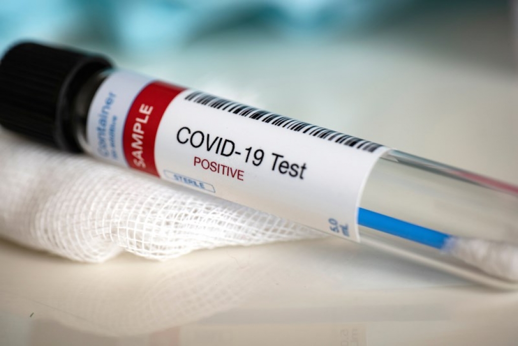 Negativan test ne znači da stvarno nemate covid-19