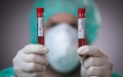 Cijena testa na koronavirus u Hrvatskoj oko 100 eura
