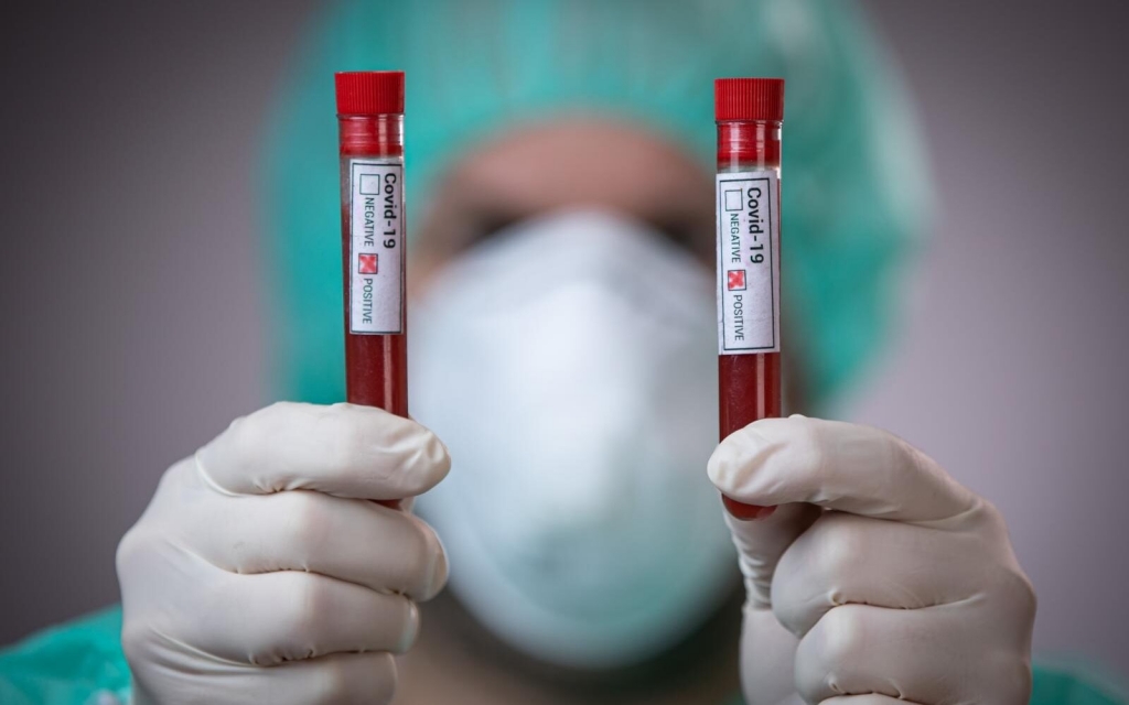 Cijena testa na koronavirus u Hrvatskoj oko 100 eura
