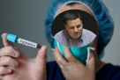 Dr. Landeka: Nema zaraženih u Ljubuškom, smanjuje se intenzitet testiranja