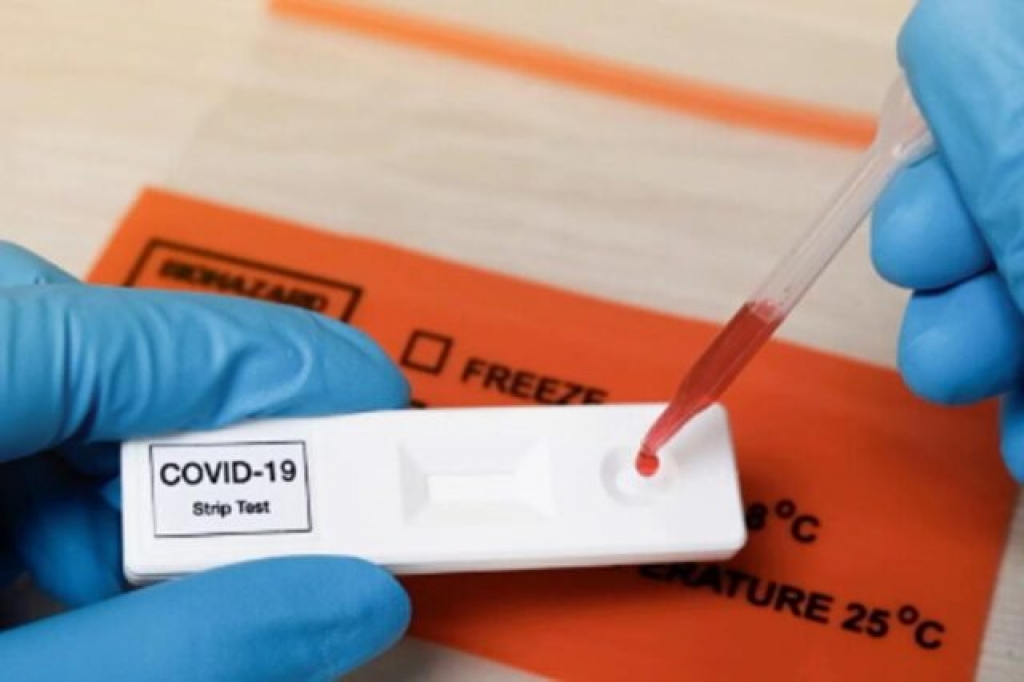 Dok drugi sve više testiraju na koronavirus, građani BiH sve teže dolaze do testova