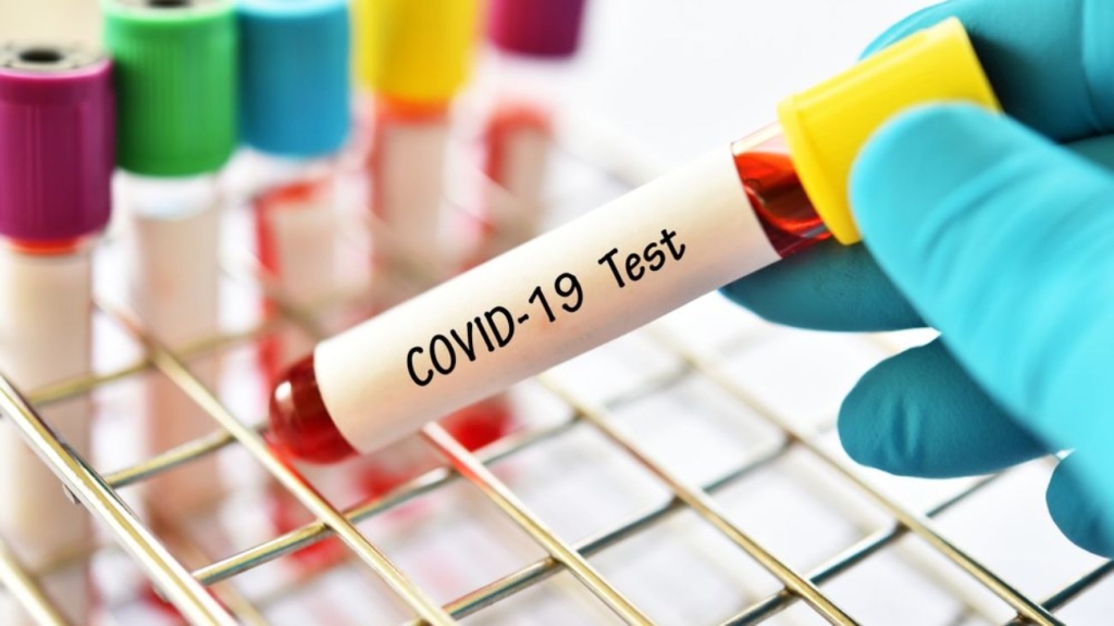 ŽZH: Registrirane su 43 novozaražene osobe na prisustvo koronavirusa