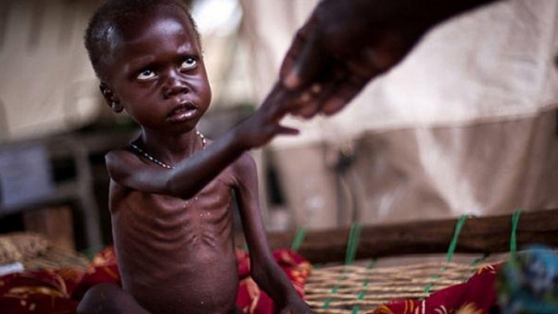 45 milijuna ljudi na jugu Afrike suočava se s glađu: 