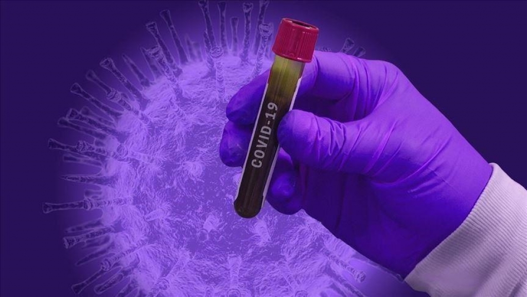 U ŽZH samo jedan novi slučaj koronavirusa