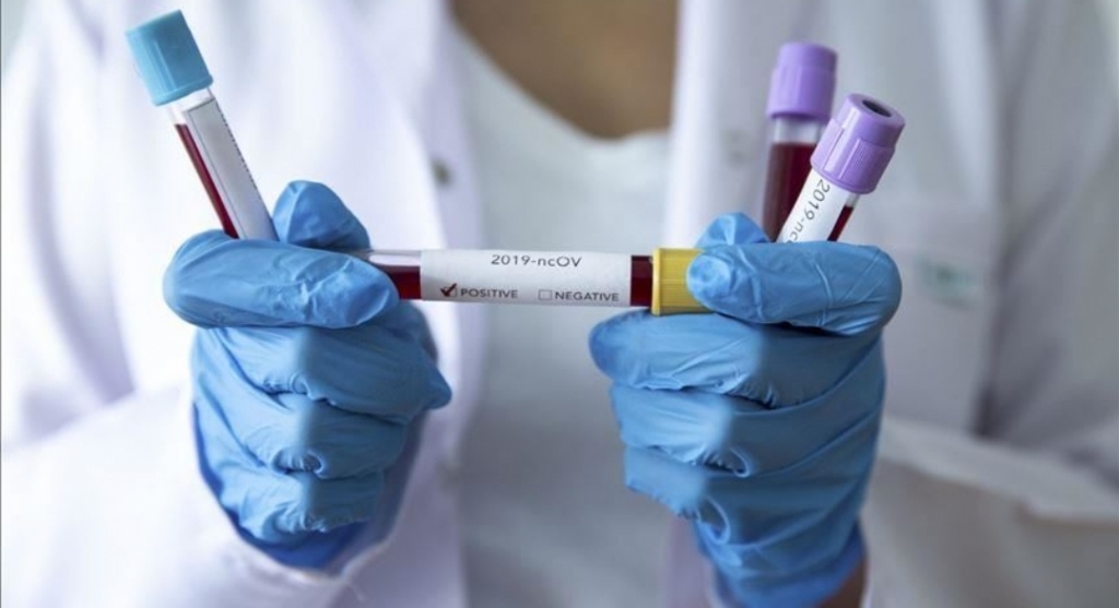 Izvrsne vijesti iz ŽZH: Nema novih slučajeva koronavirusa