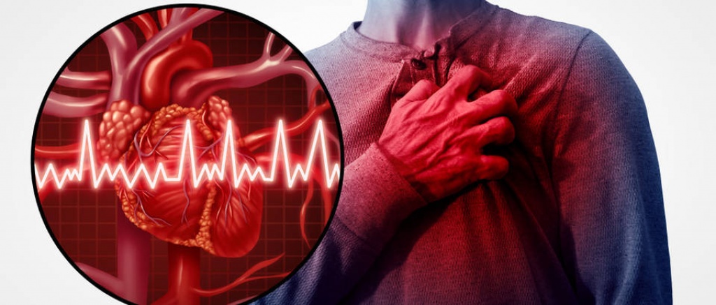 Sedam simptoma koji mogu upućivati na srčani udar