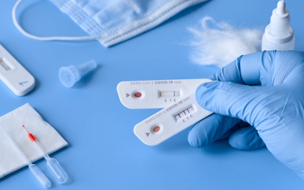 Zavod za javno zdravstvo ŽZH: Nove, jeftinije cijene komercijalnog testiranja na SARS-CoV-2
