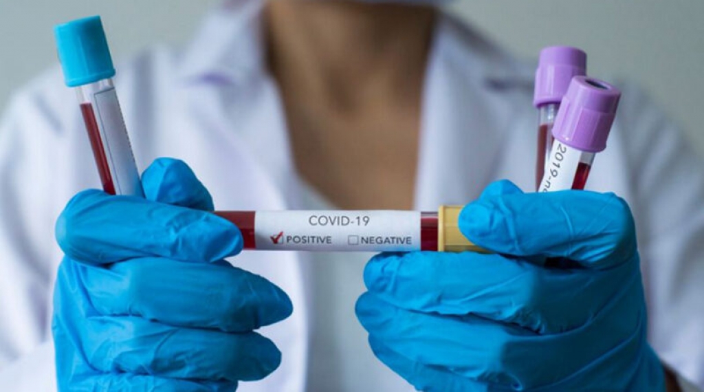Na prisustvo koronavirusa u ŽZH testirano 8 osoba