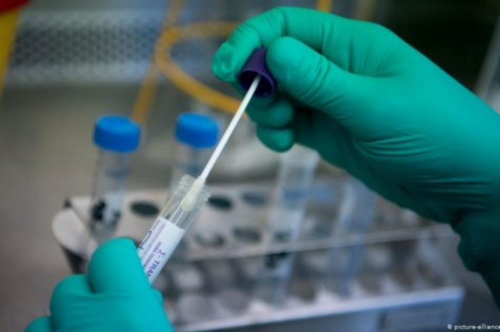 U BiH još nema govora o jeftinijim PCR testovima dok zemlje regije i EU snižavaju cijene